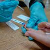 Realizan sin costo en 364 centros de Salud del estado o el Capasits en Morelia prueba rápida para detectar hepatitis C