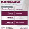 Ofrecerán mastografías gratuitas en seis municipios, del 4 al 8 de agosto